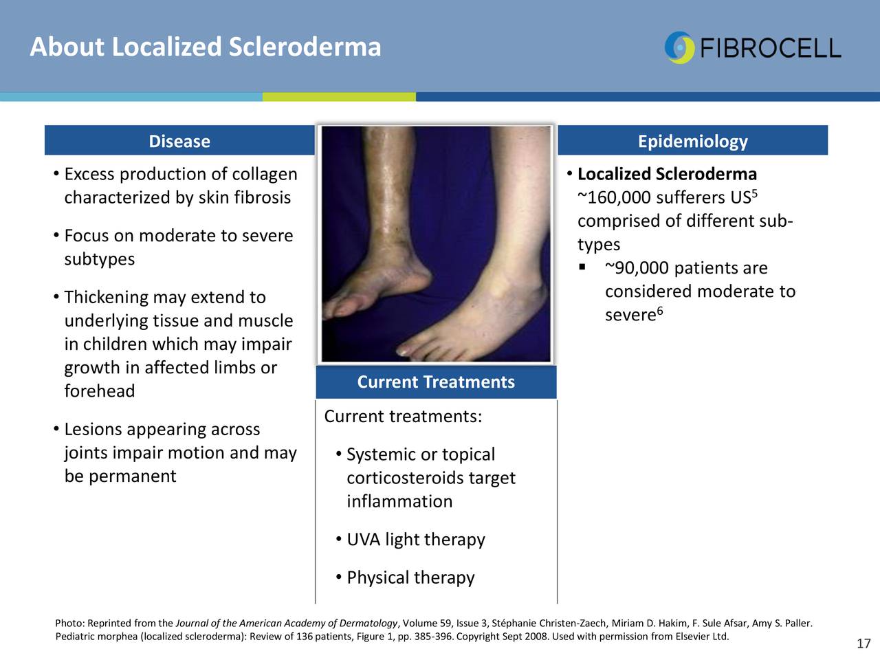 Scleroderma plaque fibrosis facial lesions