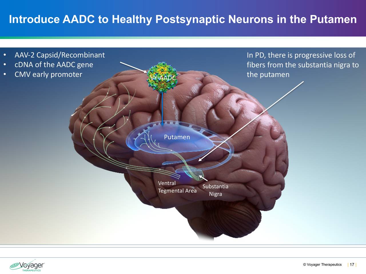 Introduce AADC to Healthy Postsynaptic Neurons in the Putamen