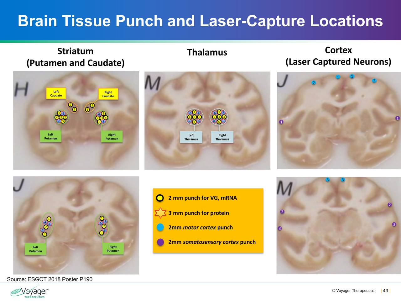 Brain Tissue Punch and Laser-Capture Locations
