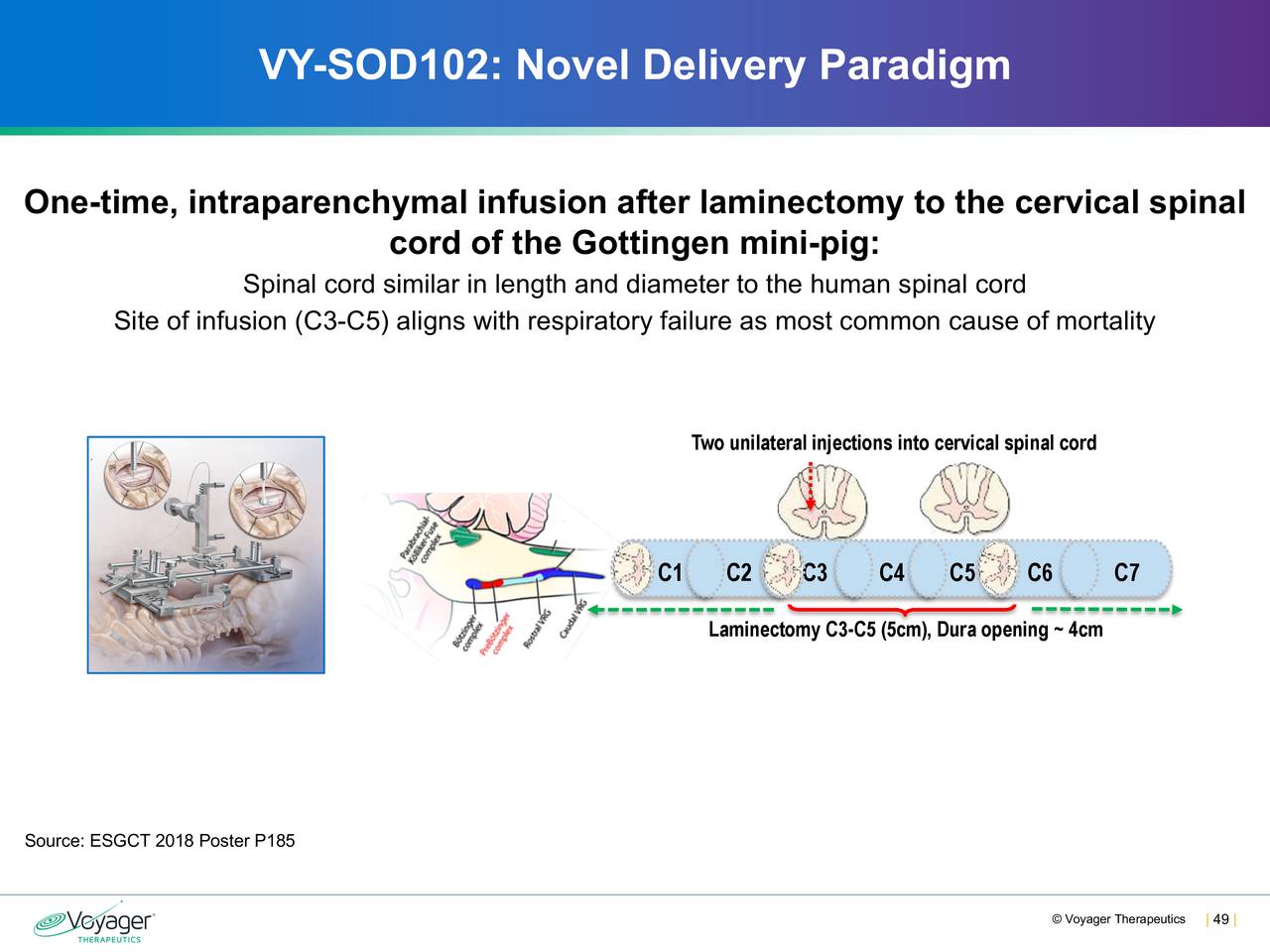 VY-SOD102: Novel Delivery Paradigm