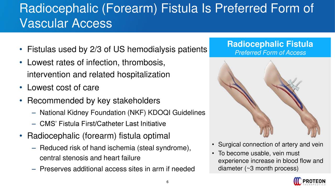 Proteon Therapeutics (PRTO) Presents at Oppenheimer 27th Annual